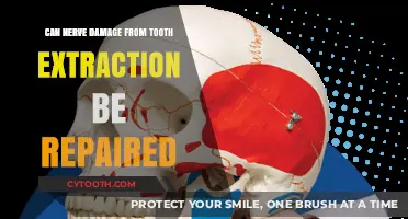 Repairing Nerve Damage After Tooth Extraction: Possibilities and Recovery Insights