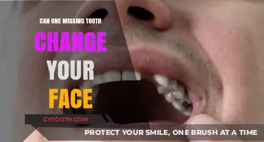 Missing Tooth Impact: How One Gap Alters Facial Appearance and Structure