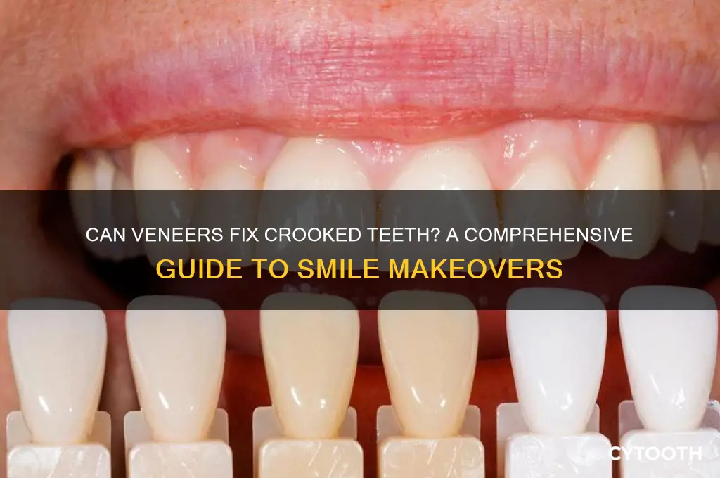 can veneers fix a crooked tooth