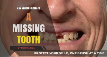 Veneers for Missing Teeth: Are They a Viable Replacement Option?