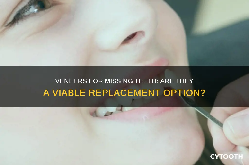can veneers replace a missing tooth