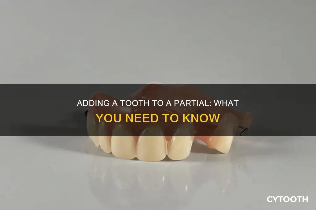 can you add a tooth to a partial