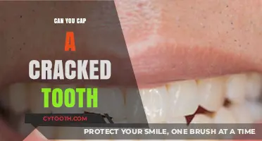 Can You Cap a Cracked Tooth? Repair Options and Dental Advice