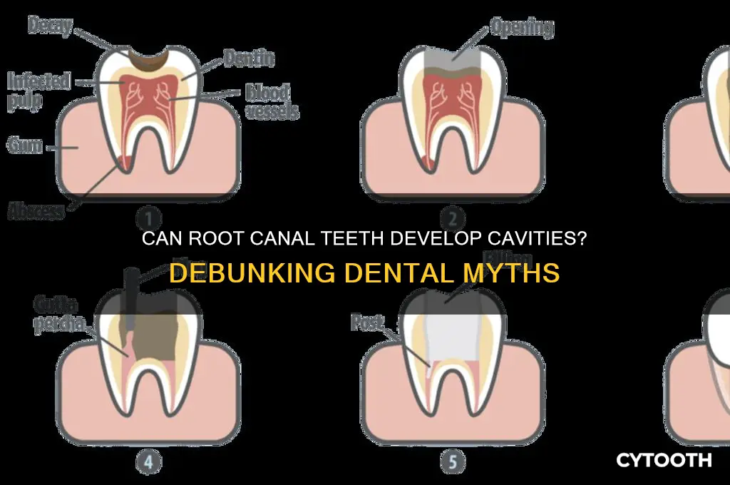 can you get a cavity in a root canal tooth