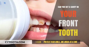 Front Tooth Cavities: Causes, Symptoms, and Prevention Tips