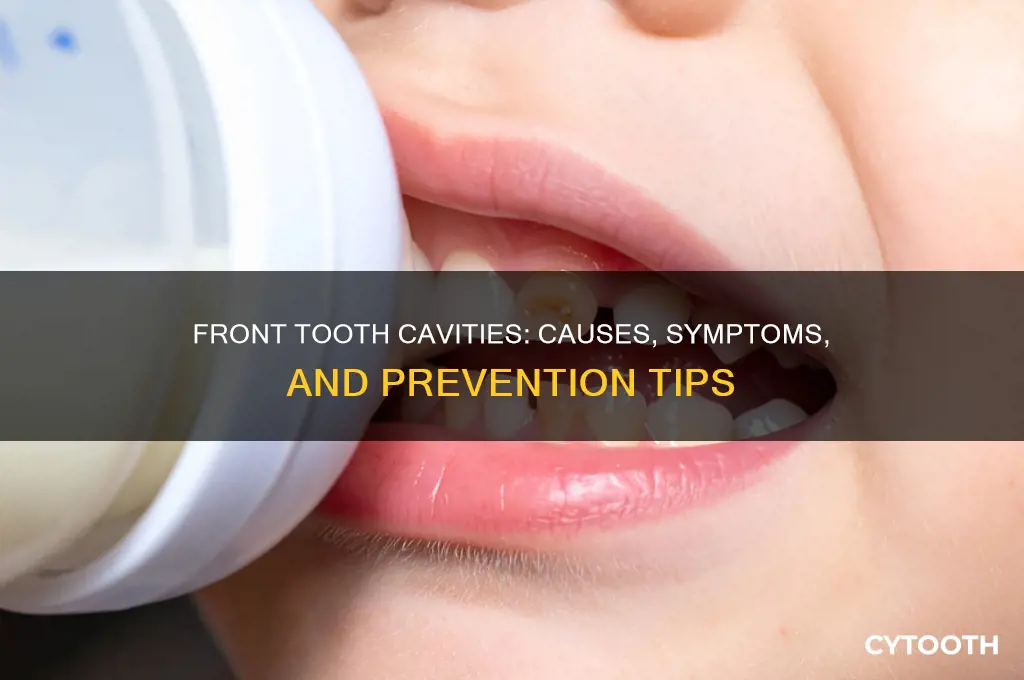 can you get a cavity in your front tooth