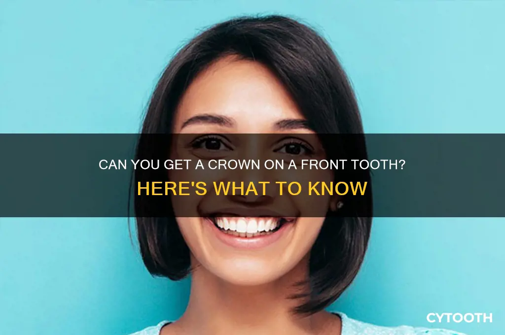 can you get a crown on a front tooth