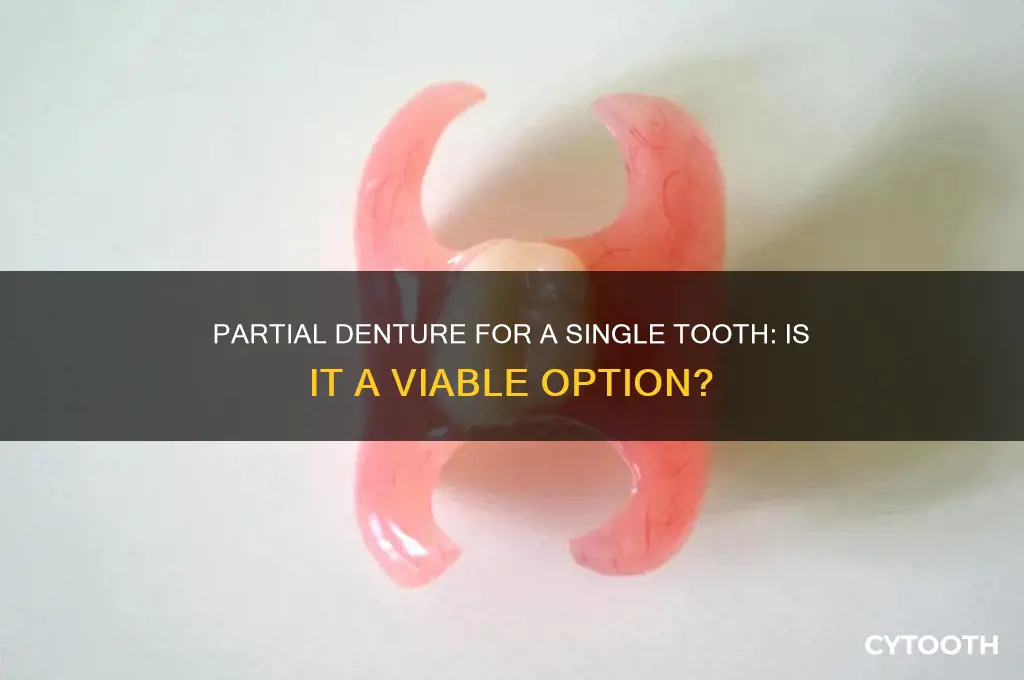 can you get a partial denture for one tooth