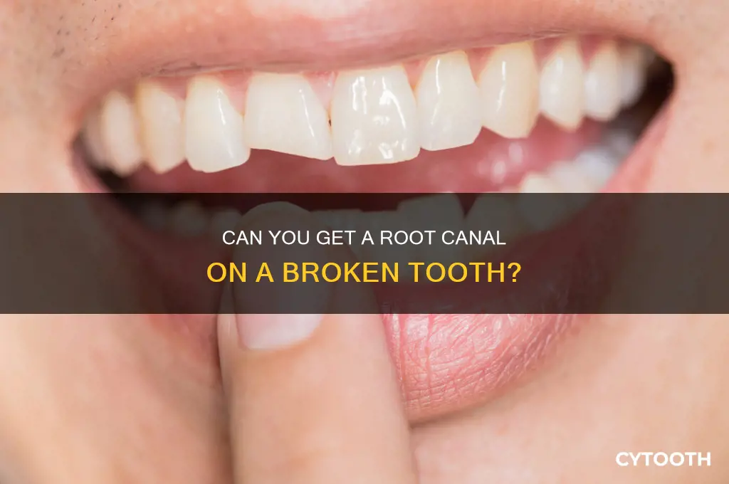 can you get a root canal on a broken tooth