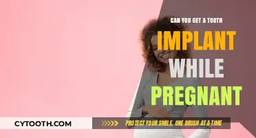 Pregnancy and Dental Implants: What You Need to Know