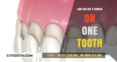 Single Tooth Veneer: Is It Possible and What You Need to Know