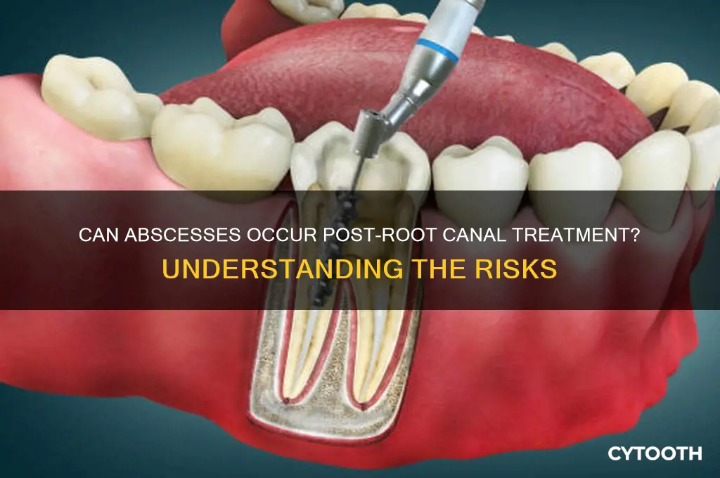 can you get an abscess after a root canal