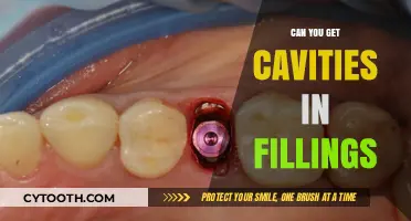 Can Cavities Form in Dental Fillings? Understanding Recurrent Decay Risks