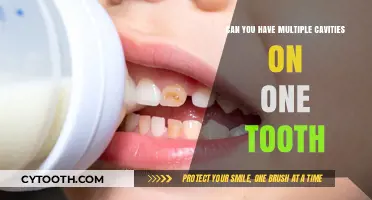 Can One Tooth Have Multiple Cavities? Surprising Dental Truths Revealed