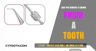 Can You Remove a Crown from a Tooth? Expert Insights and Options