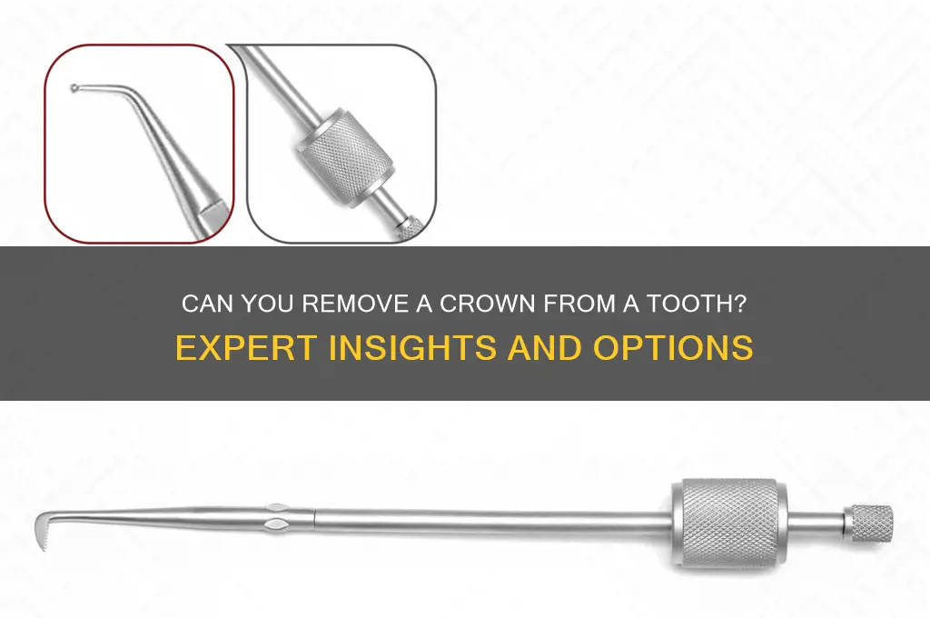 can you remove a crown from a tooth