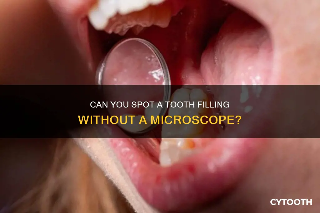 can you see the tooth filling without microscope