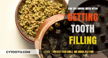 Smoking Weed Post-Tooth Filling: Risks and Recovery Tips