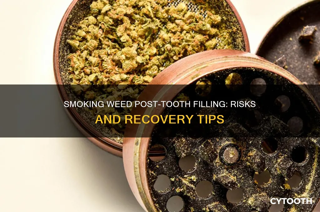 can you smoke weed after getting tooth filling