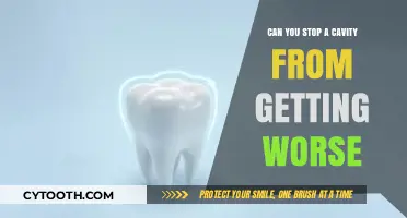 Preventing Cavity Progression: Tips to Halt Decay and Save Your Teeth