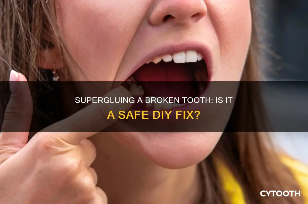 can you superglue a broken tooth