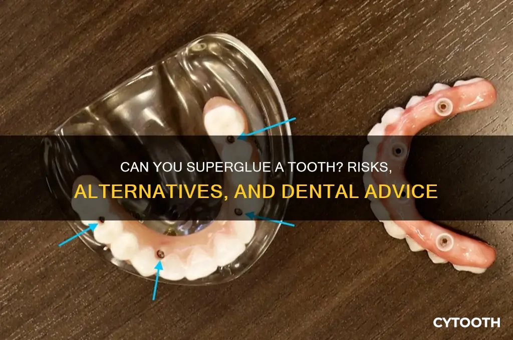 can you superglue your tooth