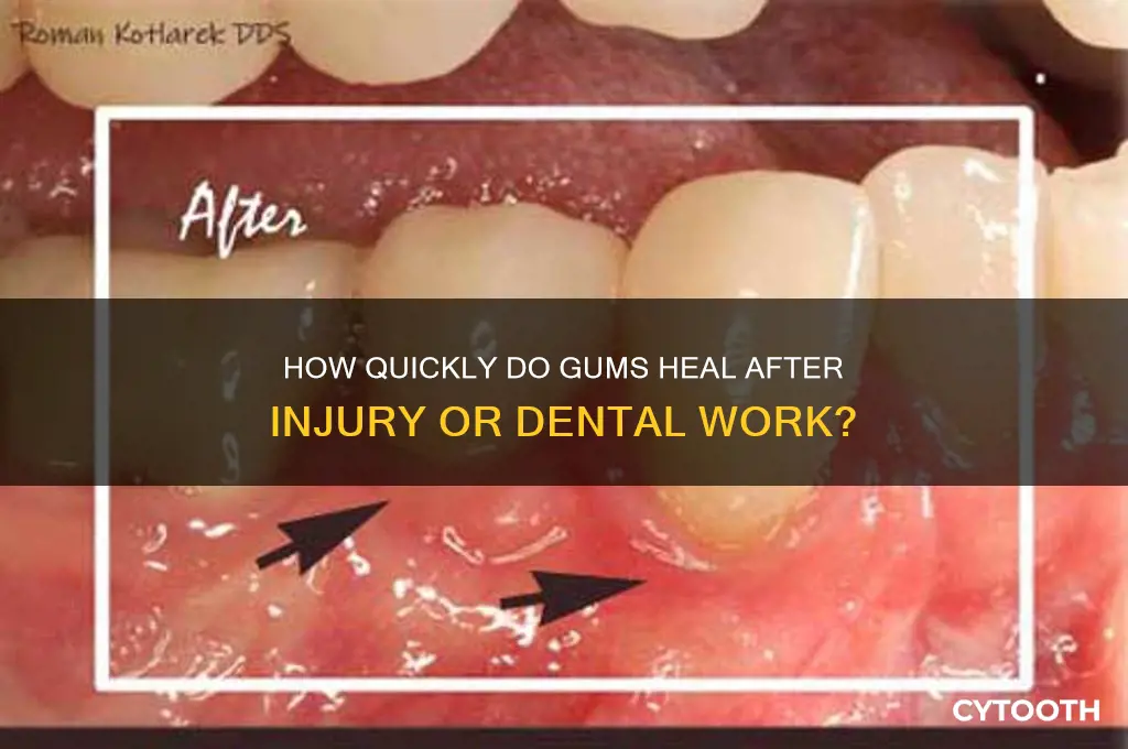 do gums heal fast