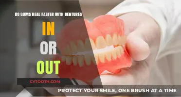 Dentures In or Out: Which Speeds Up Gum Healing?