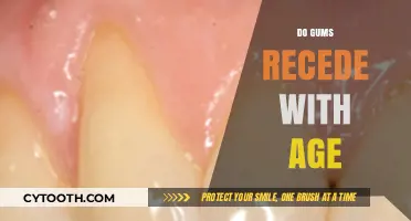 Aging and Gum Recession: Understanding Natural Changes in Oral Health