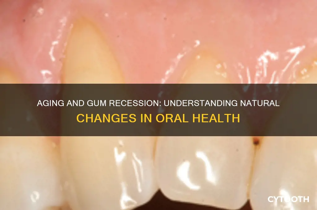 do gums recede with age