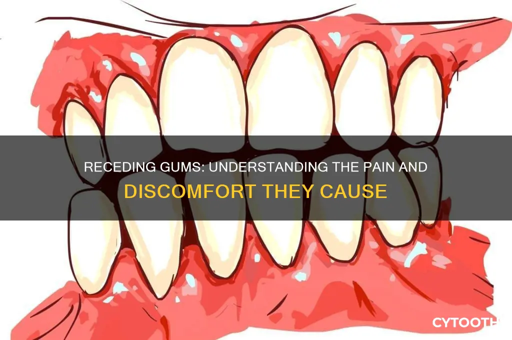 do receding gums hurt