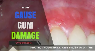 Zyns and Gum Health: Uncovering the Truth About Potential Damage