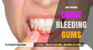 Anemia and Bleeding Gums: Uncovering the Surprising Connection and Risks