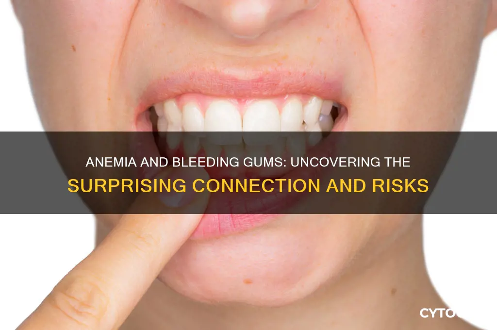 does anemia cause bleeding gums