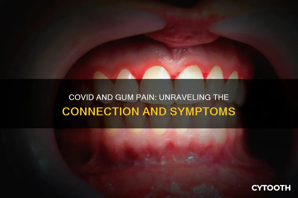 does covid make your gums hurt