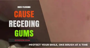 Flossing and Gum Recession: Separating Fact from Fiction