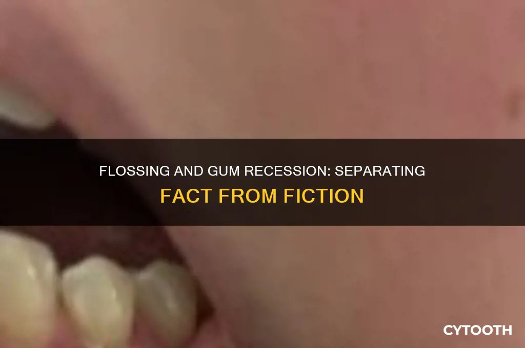 does flossing cause receding gums