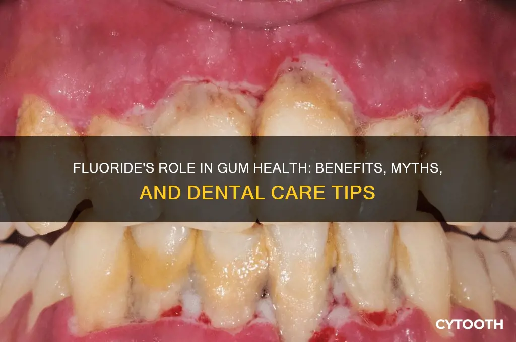 does fluoride help gums