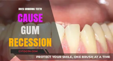 Teeth Grinding and Gum Recession: Uncovering the Hidden Connection
