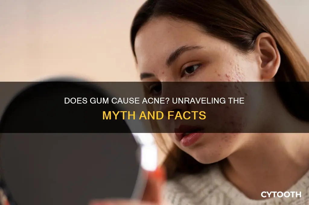 does gum cause acne