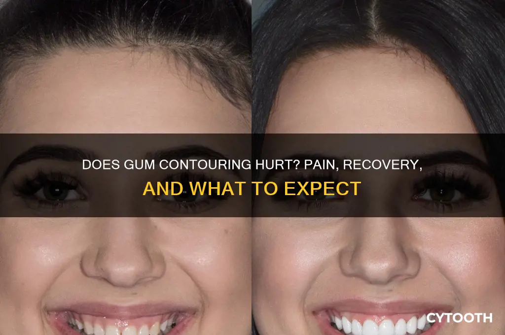 does gum contouring hurt