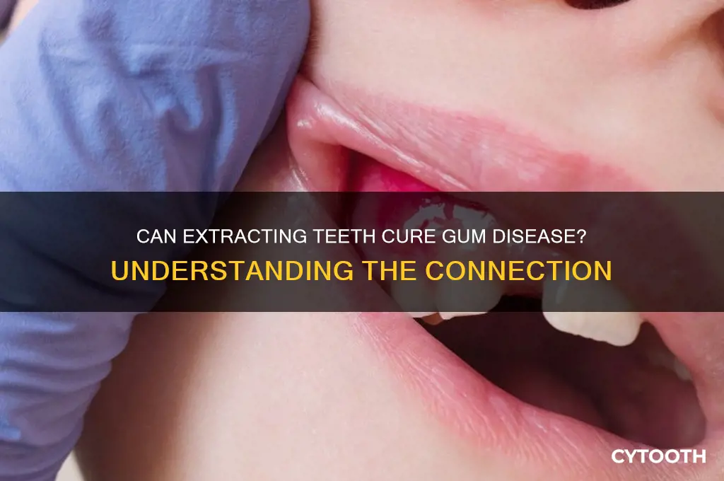 does gum disease go away when teeth are removed