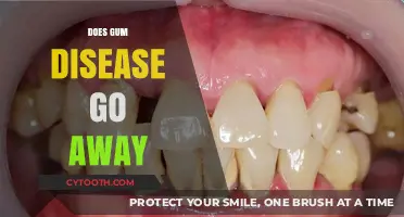 Can Gum Disease Be Cured? Understanding Treatment and Prevention
