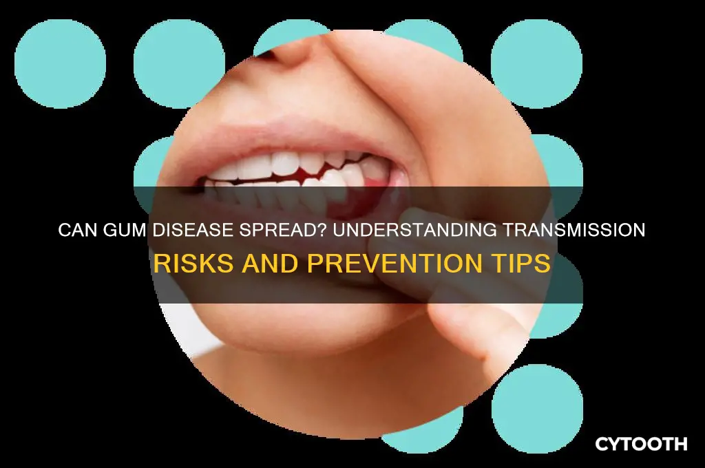 does gum disease spread