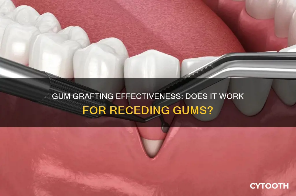 does gum grafting work