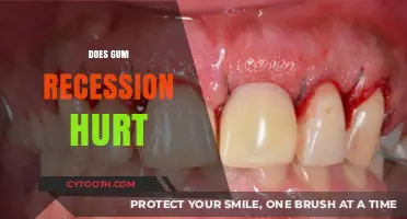 Does Gum Recession Hurt? Understanding the Pain and Solutions