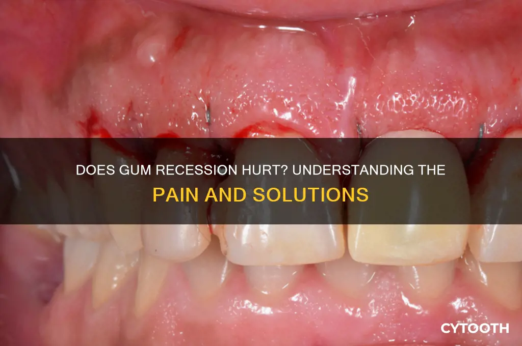 does gum recession hurt