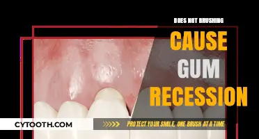 Skipping Brushing: How Poor Oral Hygiene Leads to Gum Recession
