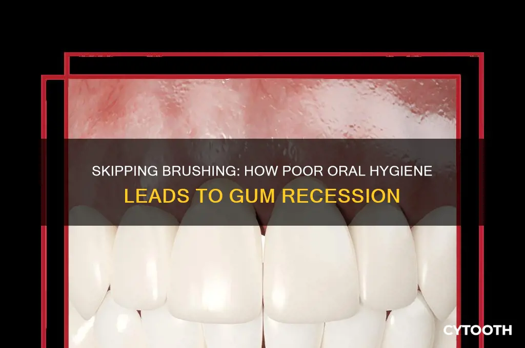 does not brushing cause gum recession