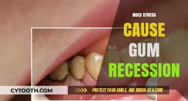Stress and Gum Recession: Uncovering the Surprising Connection and Prevention Tips